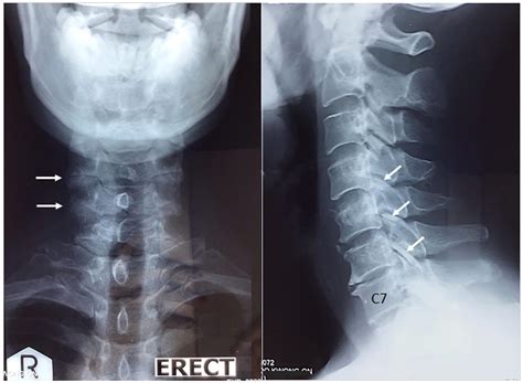j med cases.